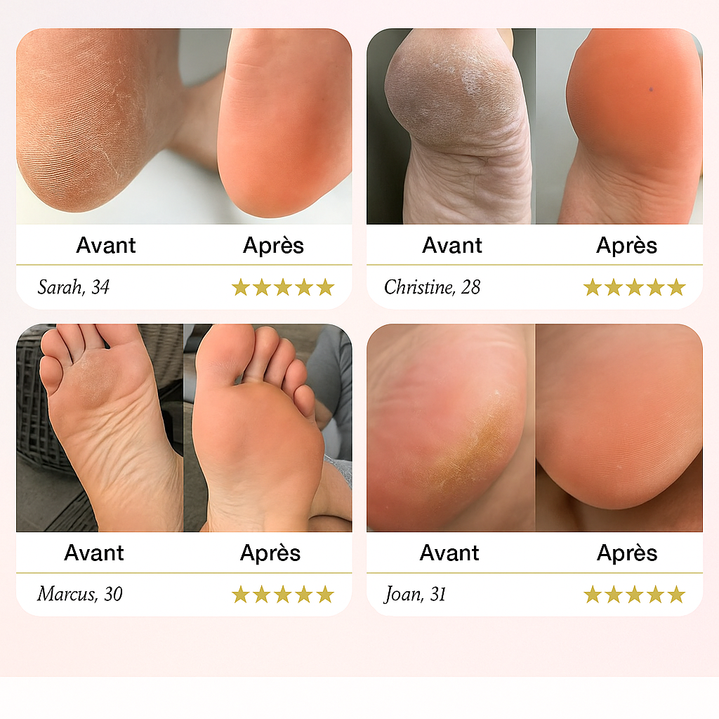 Qualibaz™ | Râpe Électrique pour Pieds