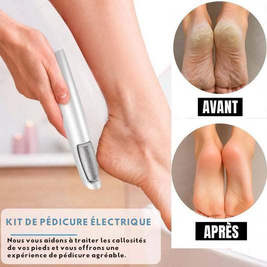 Qualibaz Lime à callosités pour pieds